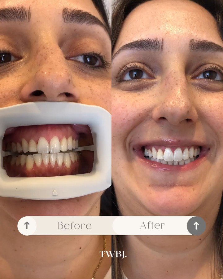 Lately with TWBJ&hellip; ✨

brighter smiles, busy days, welcoming the silly season well and truly, hello December!! 
While we celebrated the magic 2025 has given us 🥂

Limited availabilities left for the remaining of the year 🎄 

Book online to sec