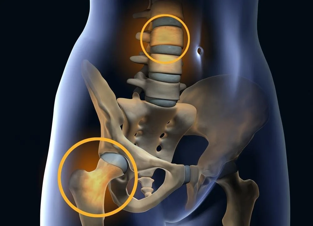 Understanding Musculoskeletal Health: Tips to Prevent Pain and Stay Active