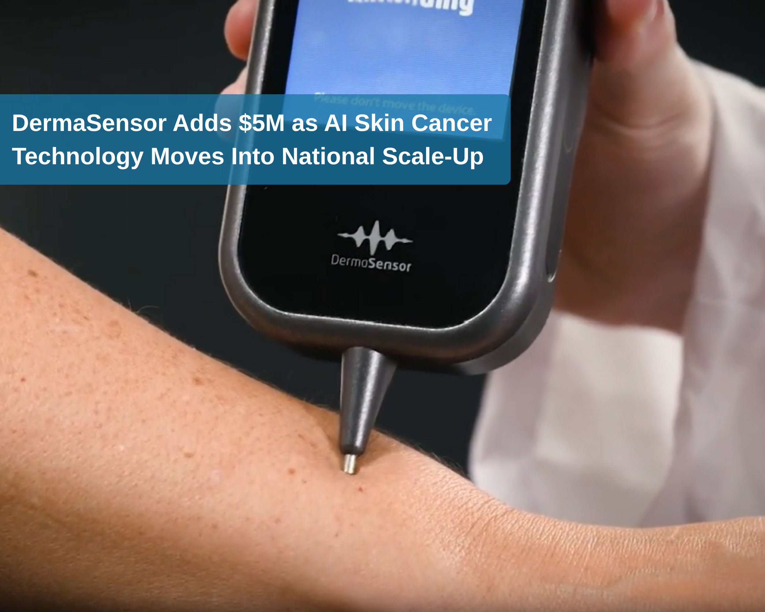 DermaSensor Adds $5M as AI Skin Cancer Technology Moves Into National Scale-Up