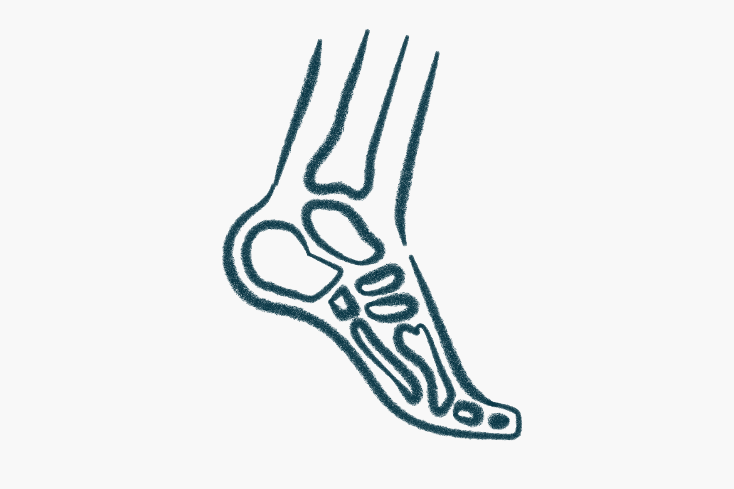 Orthopaedic Pain - when to get help