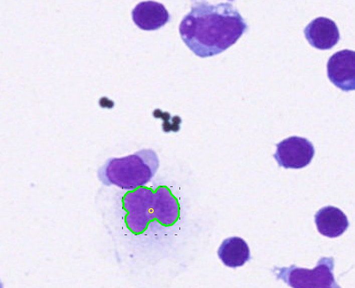 Seeing what other miss in 3D digital cytology 