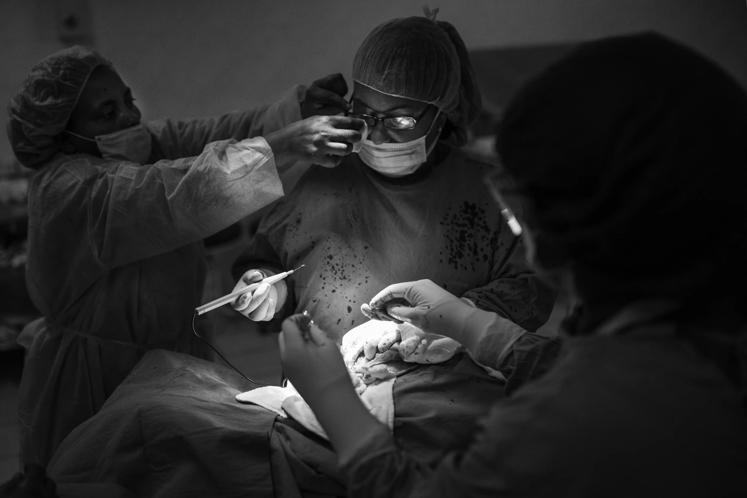 En una sala de operaciones, un equipo de cirujanos realiza una cirugía en un paciente. Todos llevan batas, guantes, mascarillas y protectores. La escena es en blanco y negro.