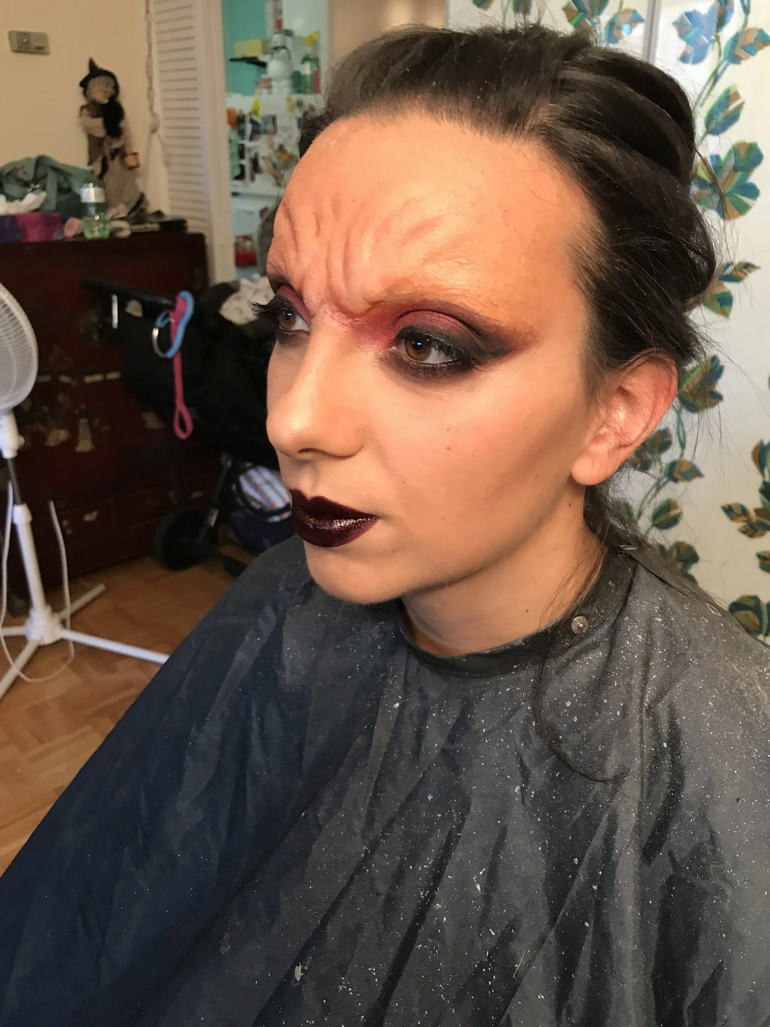 prosthetic forehead