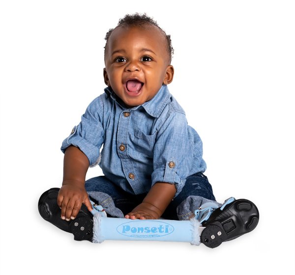 A young baby sitting on the floor with a big smile, wearing a fixed abduction brace for Ponseti correction of clubfoot.