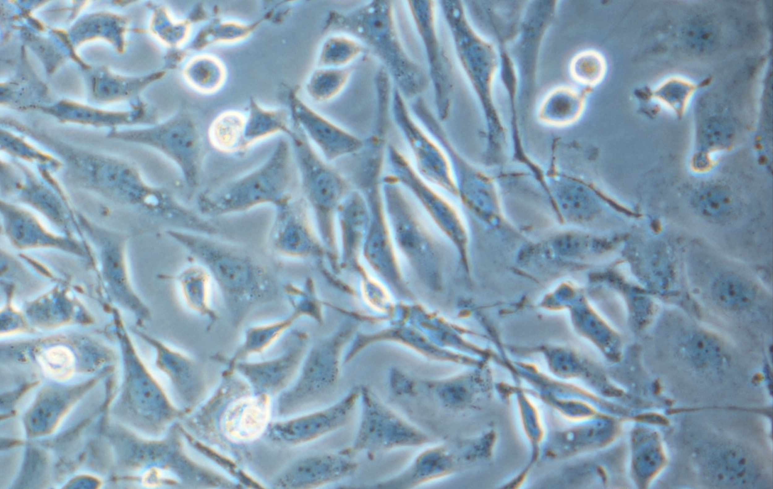 Case Study: J&amp;J CHO Cell Productivity