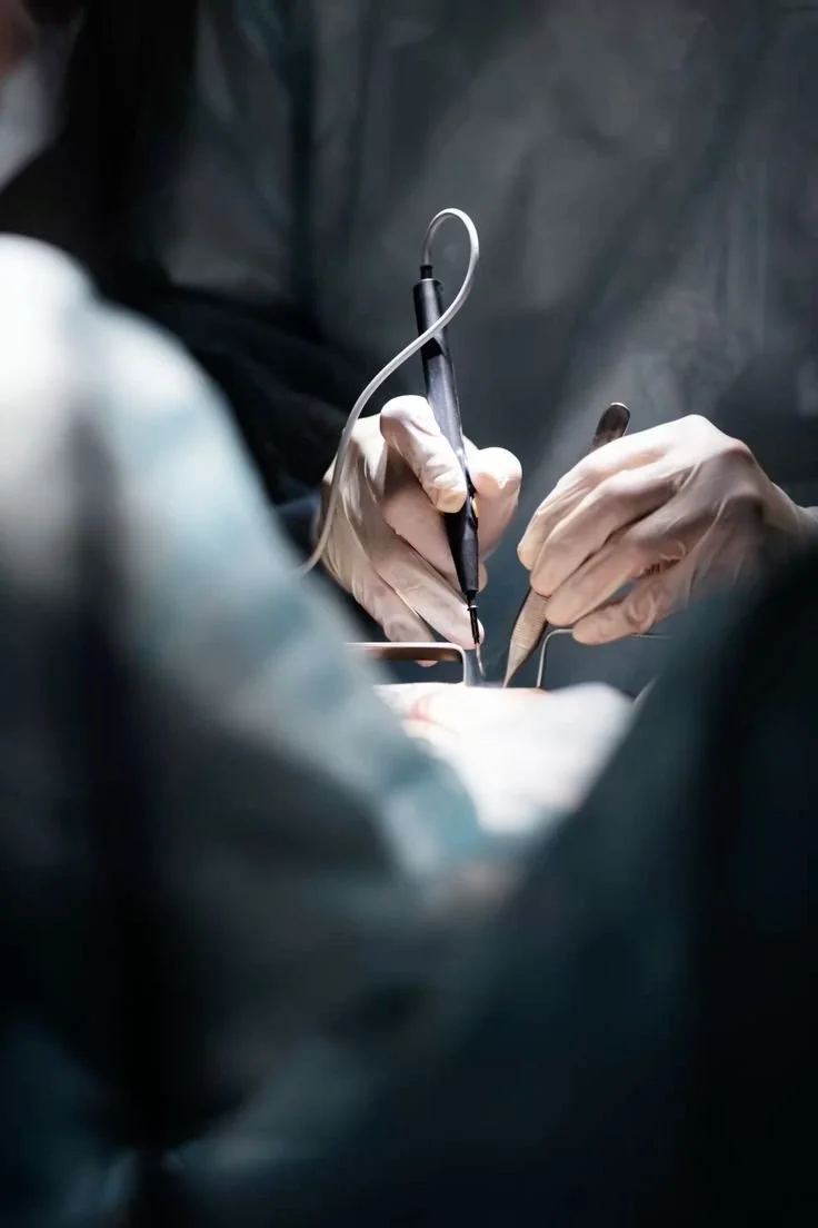 Una persona indossa guanti chirurgici mentre usa strumenti per un intervento chirurgico. La scena si svolge in un ambiente medico.