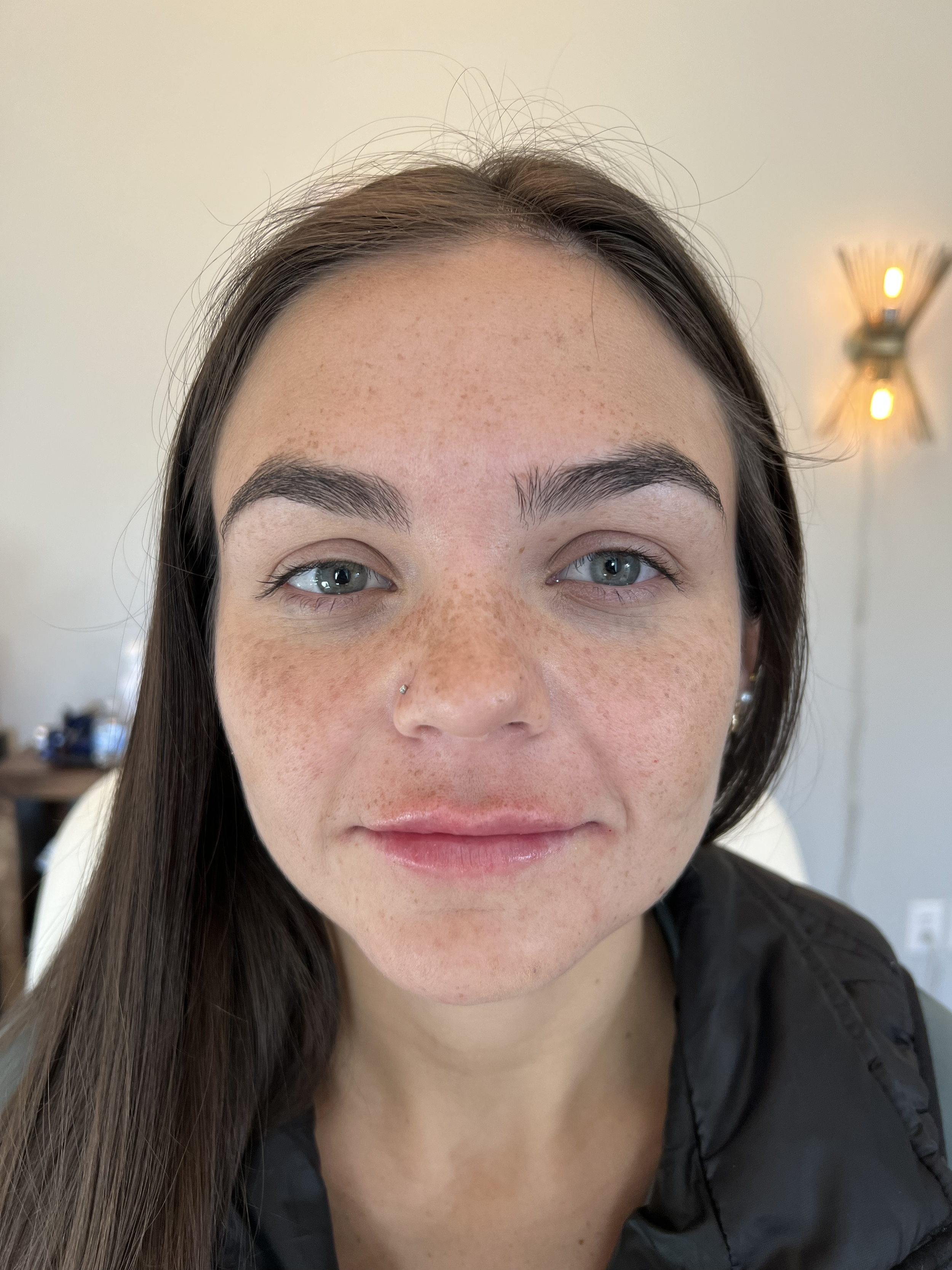 Lips After Dermal Filler at House of Aesthetics in Wilmington - front .png