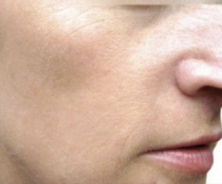 After Halo Laser 4.png