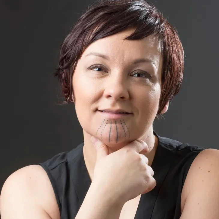 A woman with short, dark hair, smirking slightly and resting her chin on her hand, with dotted lines and marks drawn on her chin indicating a planned cosmetic procedure.