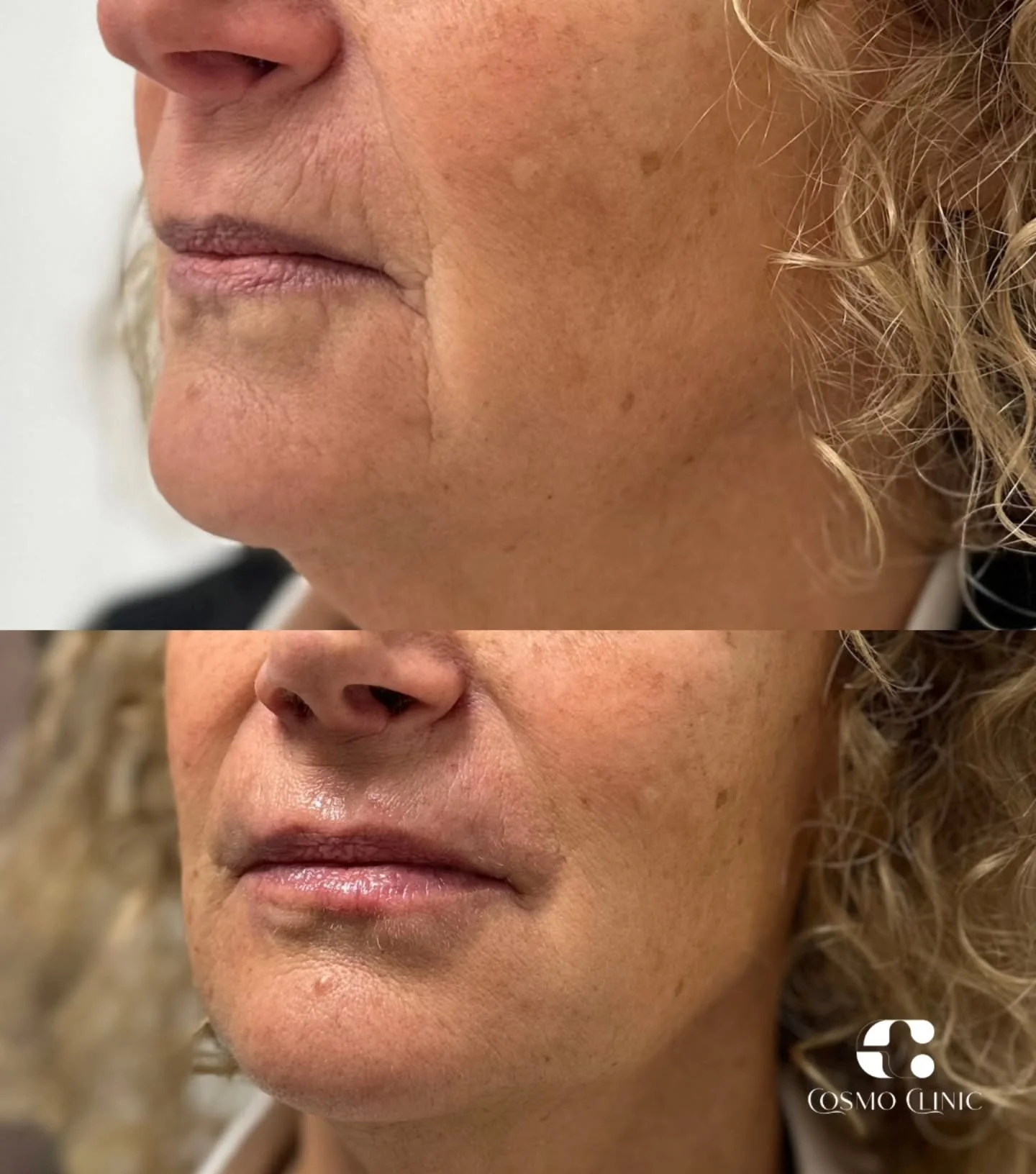 Grąžiname tai,ką laikas atėmė. 

Para&scaron;yk mums ir sužinok daugiau!