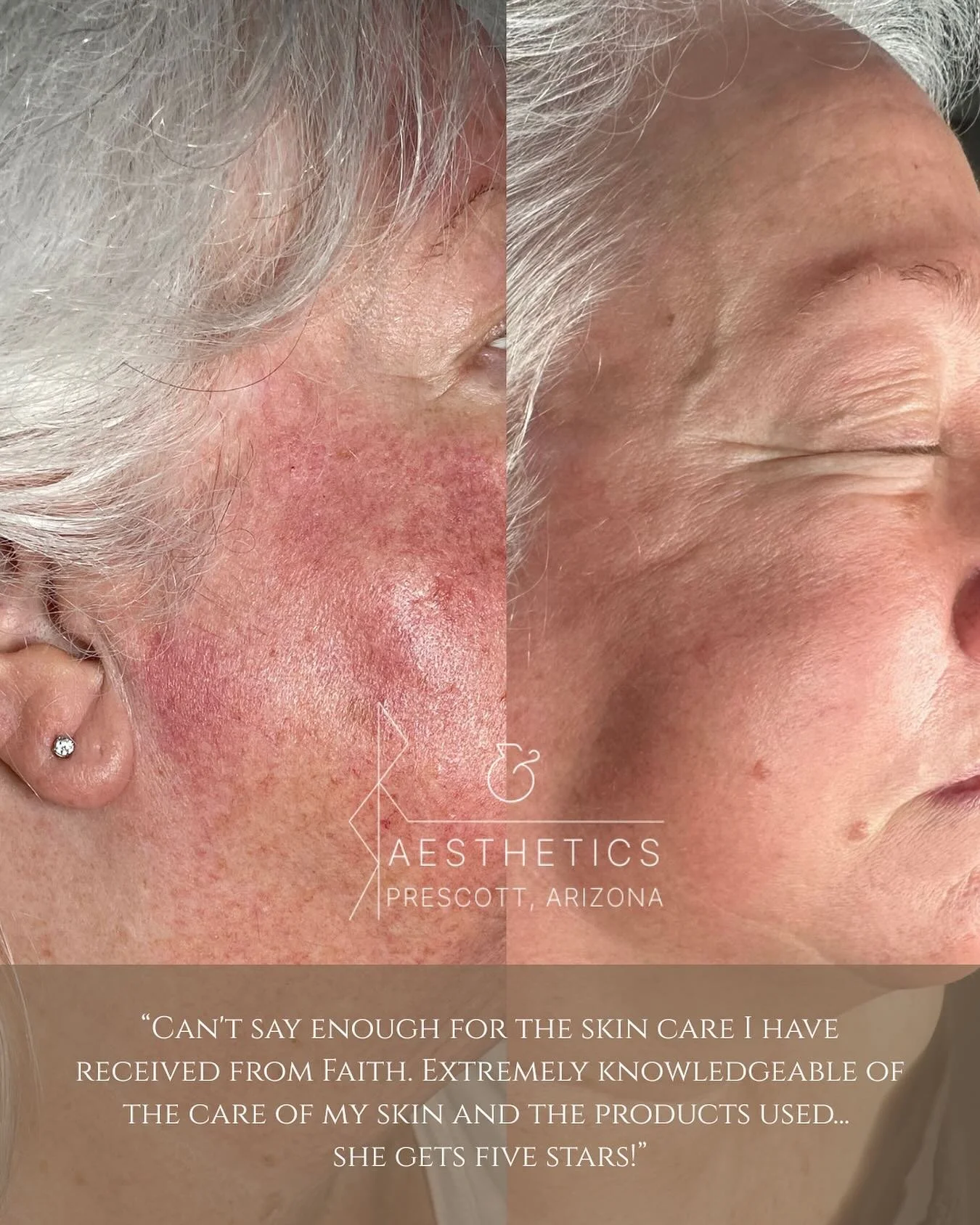 This is what root communication looks like🙏

This transformation is one of my all time favorites, it&rsquo;s the result of supportive care, consistency, and trust in the process! When we stay attuned to what the skin is saying, listen to its cues, a