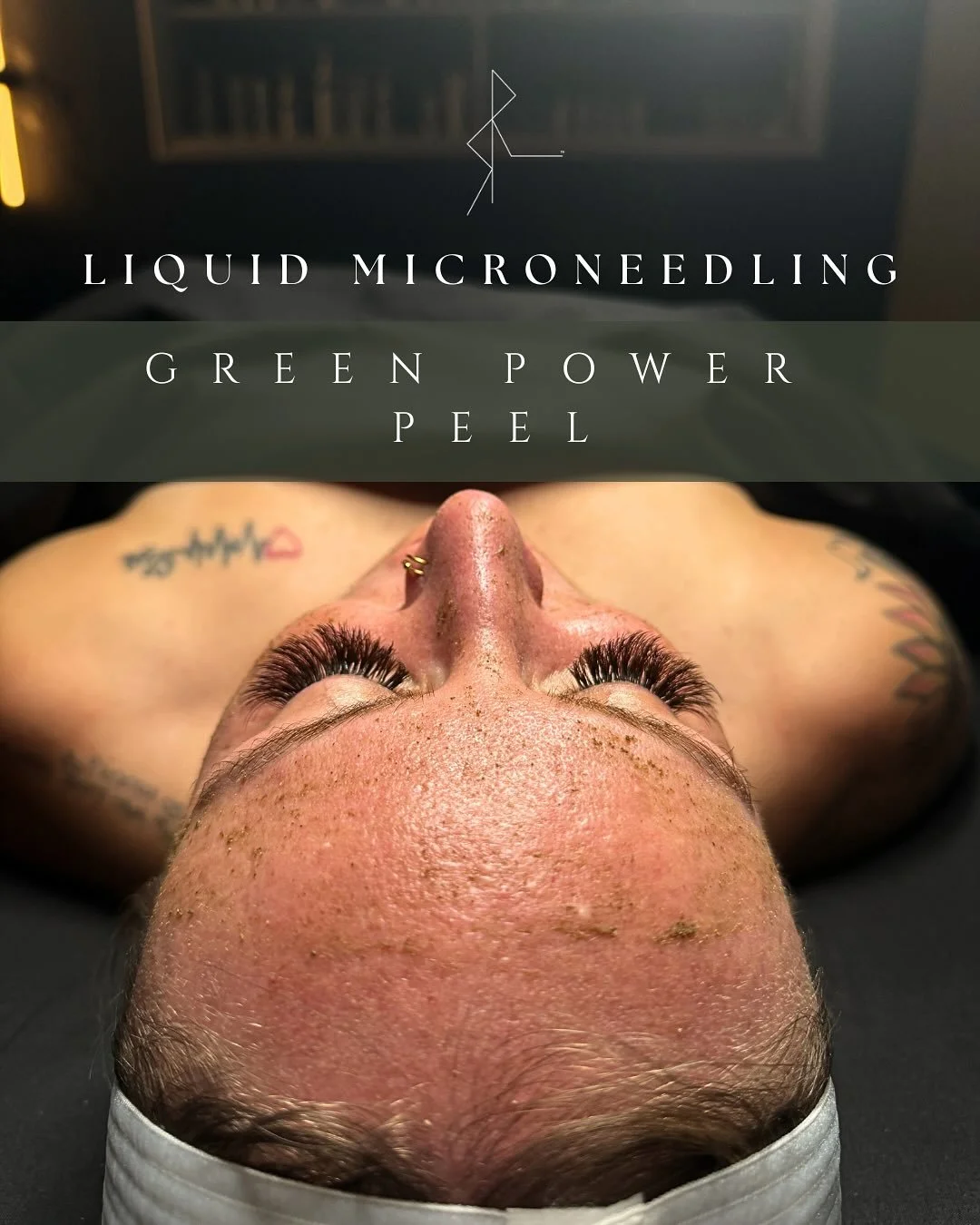 One of my all time favorite peels-The Green Power Peel by @liraclinical is available as a powerful upgrade to any peel series or a standalone treatment.

It works by stimulating your skin&rsquo;s natural repair cycle to strengthen collagen, refine te