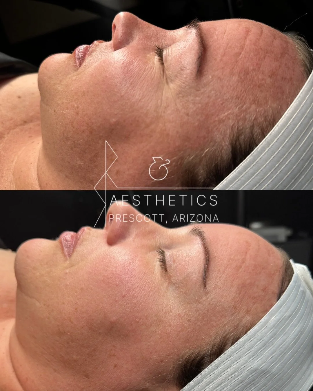 I love quick results. Truly. Instant gratification has its place in this industry, and when it&rsquo;s appropriate, it can be great.

But too often we see over-promising, not only that but we see it romanticized over something far greater to respect.