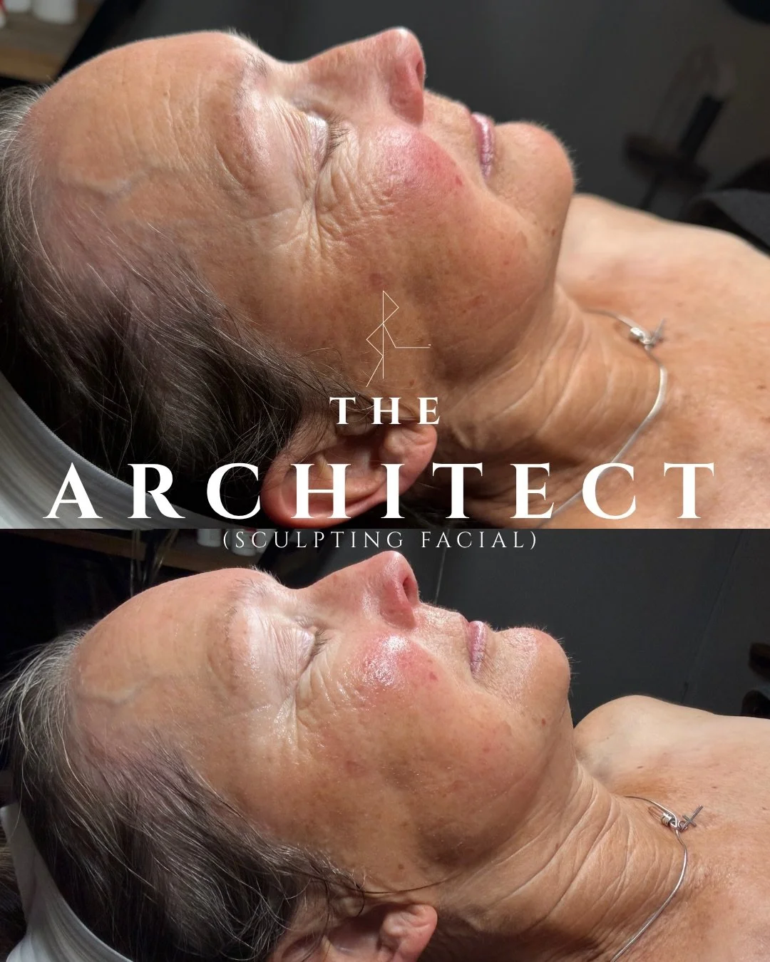 My beautiful client had felt disconnected from her skin and I wanted to show her what is already right there and just needs a little support! 

The Architect facial is about bringing you back to your foundation. What&rsquo;s already there but waiting