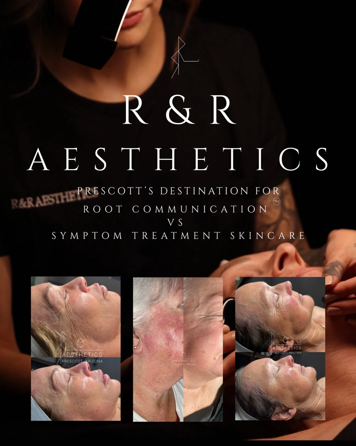 Seven years ago, I opened R&amp;R Aesthetics here in Prescott with a philosophy of root communication versus symptom treatment skincare, all while prioritizing the niche of massage focused facials with a luxury and holistic approach.

Your skin is a 