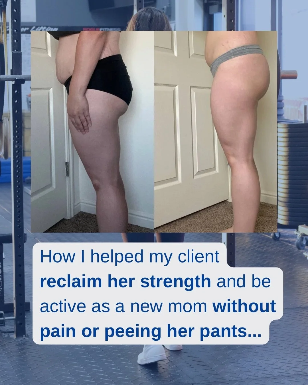 My client, J, came to me when she was 5 months PP looking to feel strong again. 

She had always loved lifting weights and having a muscular physique. She knew she needed a professional&rsquo;s help to restore her core and pelvic floor so she could g