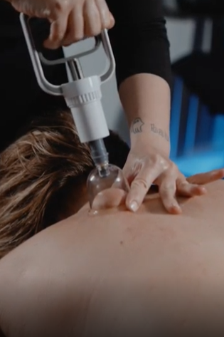 A person receiving cupping therapy on their back in a spa like setting.