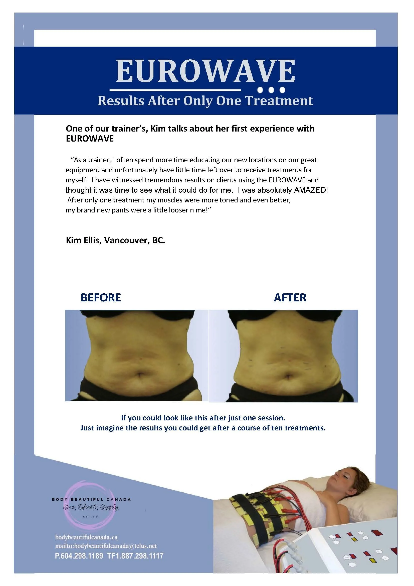 A flyer for EUROWAVE shows before and after photos of a woman's midsection, highlighting weight loss or body contouring results after one treatment. It includes a testimonial from Kim Ellis from Vancouver, BC, and an image of a woman lying on a bed w