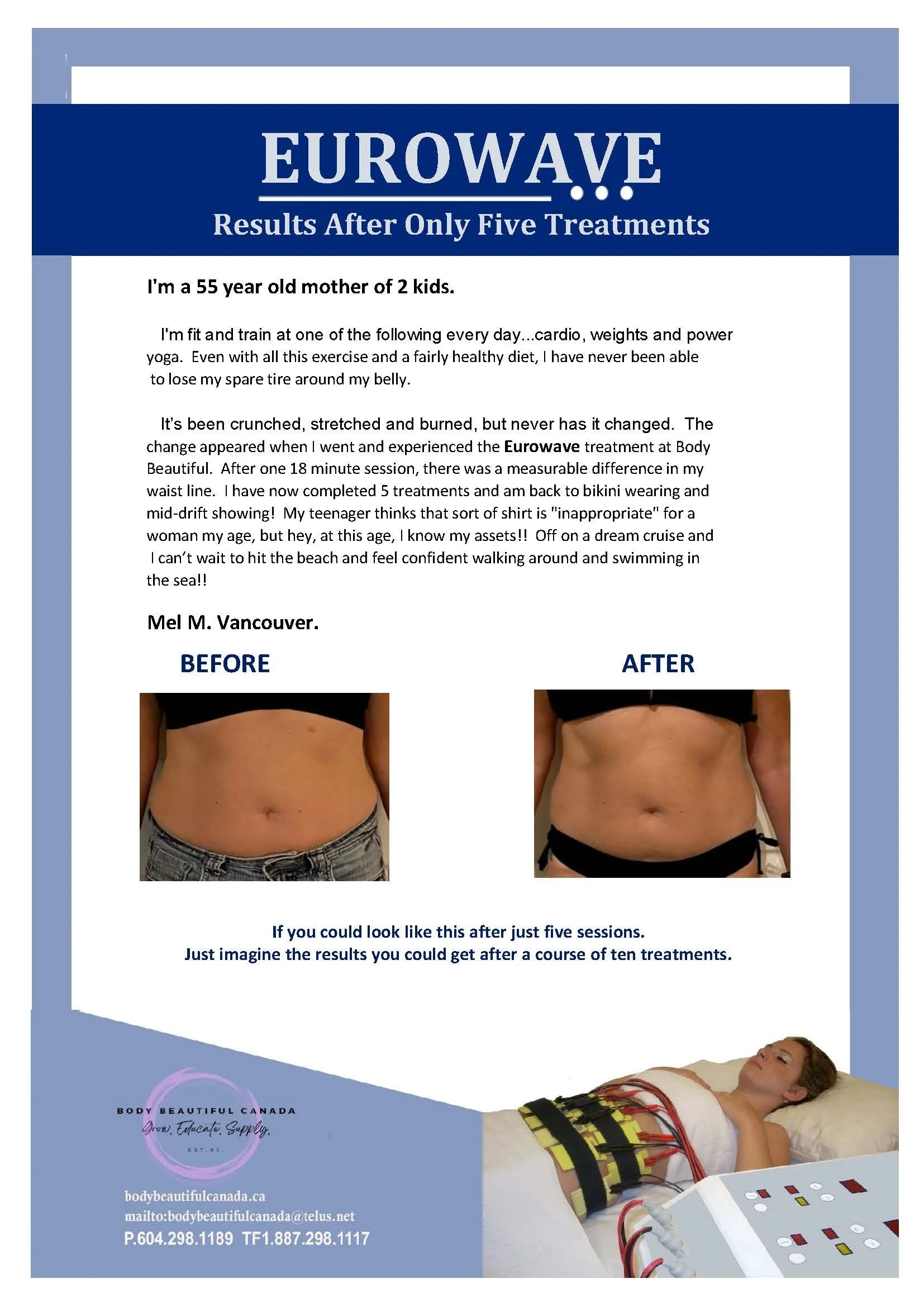 Advertisement for Eurowave treatment with before and after images showing abdominal transformation, featuring a woman in her 50s. The ad highlights results after five treatments, emphasizing improved waistline and confidence.