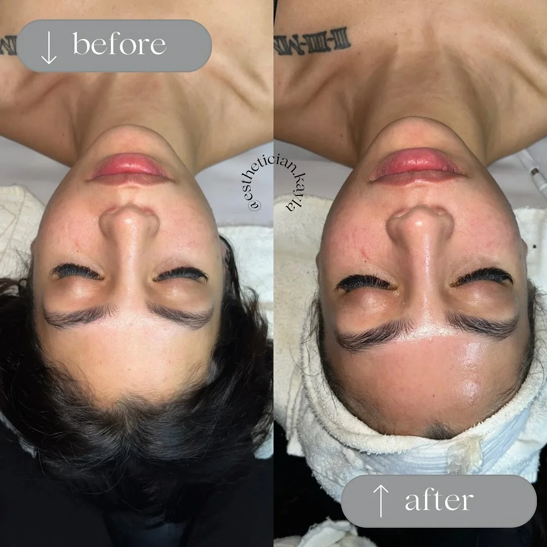 Say goodbye to dead skin cells and hello to a healthy, youthful glow 😍 

The Blueberry Enzyme, rich in antioxidants, works wonders. Infused with gentle glycolic and salicylic acids, it brightens by dissolving dead skin cells and softening sebum. Blu