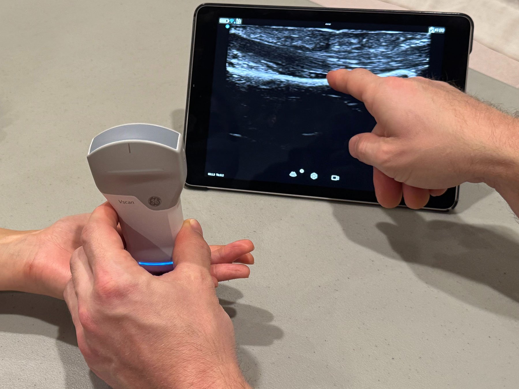 Person using a handheld ultrasound device to scan a patient's ankle, with the ultrasound image displayed on a tablet in the background.
