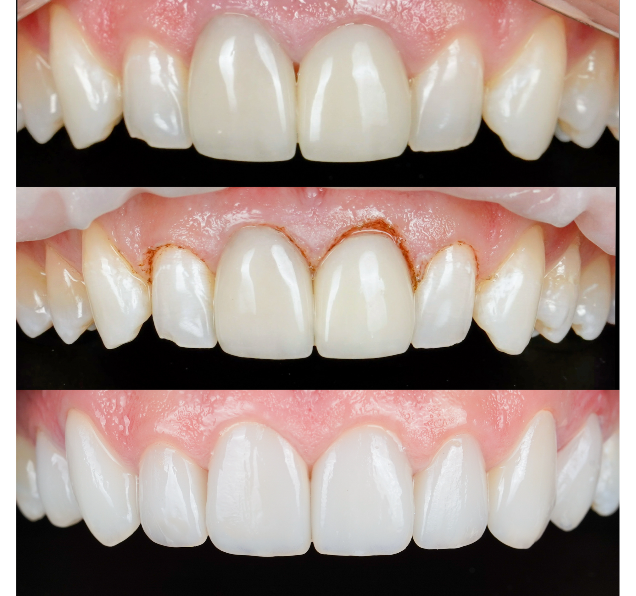 Oral Laser Treatments (Gum Reshaping, cavity removal...)