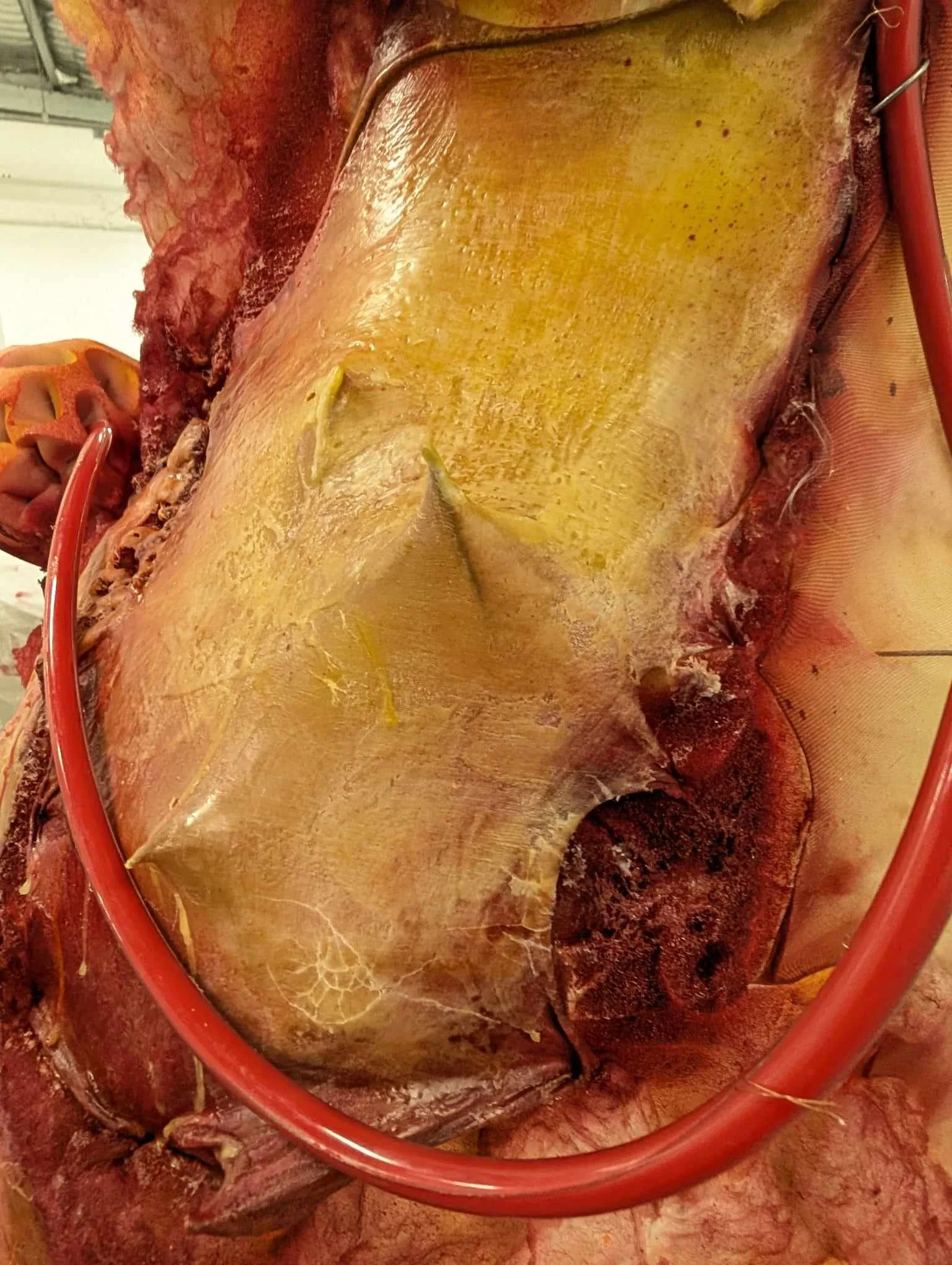 EPIGLOTTIS DETAIL .1.jpg