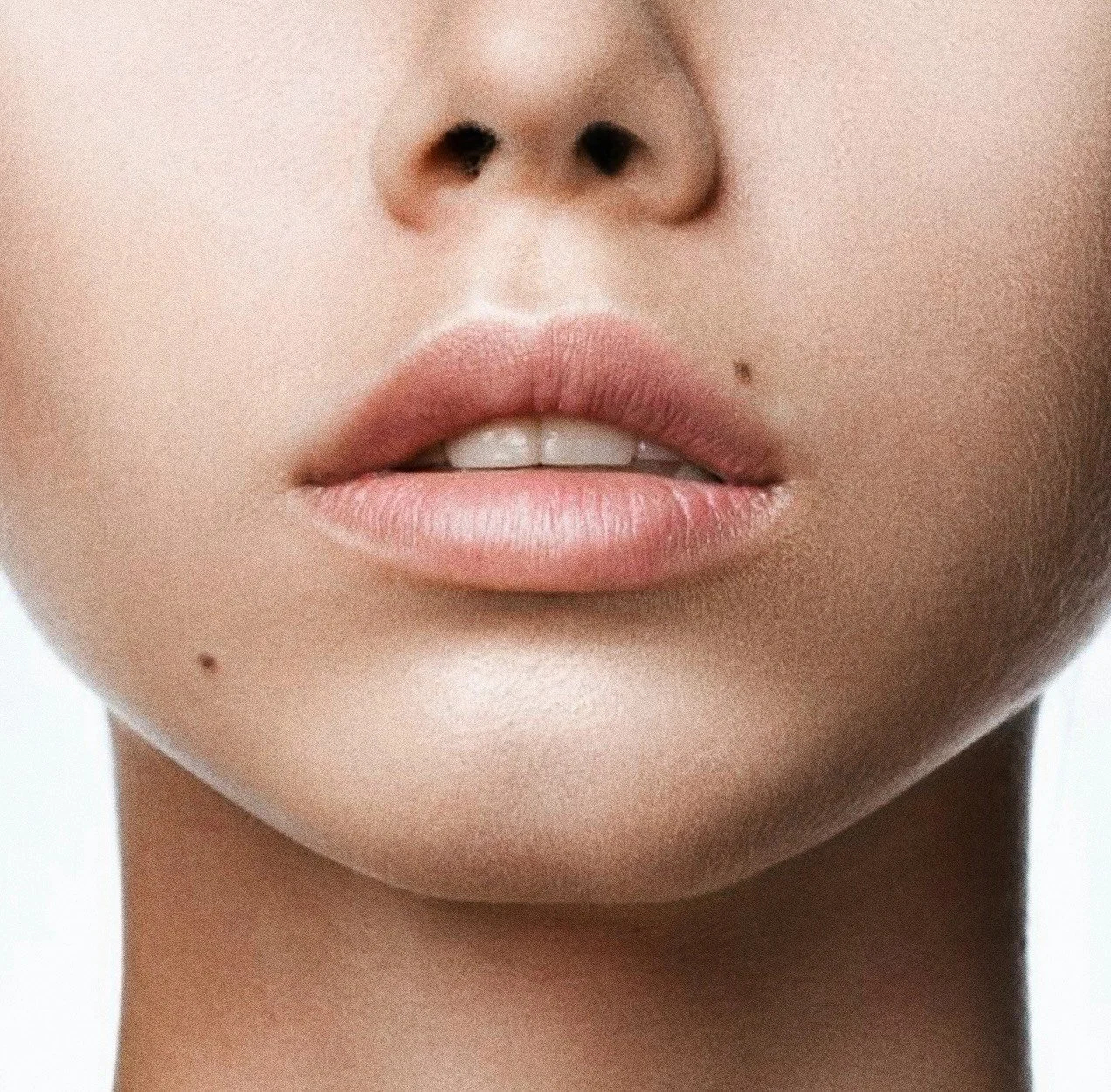 Tarkka close-up kuva ihmisen suupielistä, nenästä ja leuasta, korostaen huulten muotoa ja nahkakudosta.
