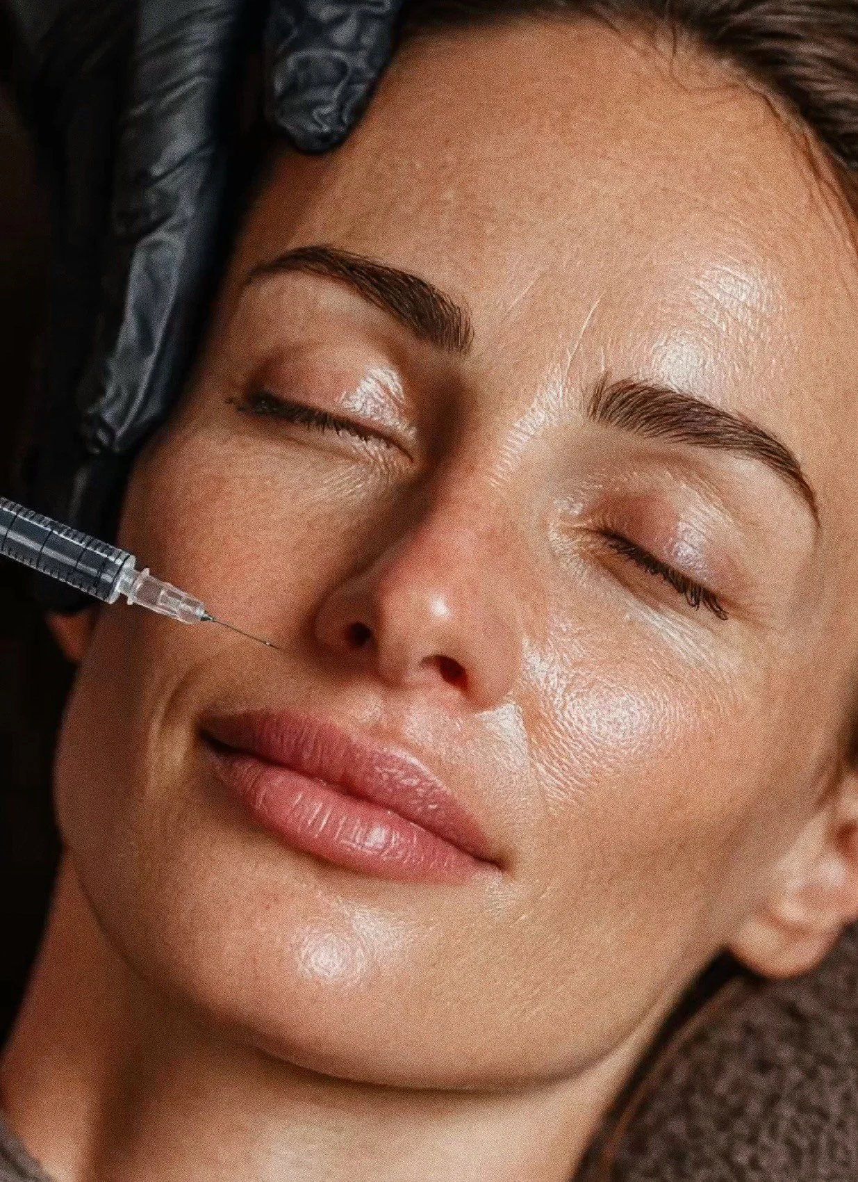 Nuoren naisen kasvot, joka saa täyteainetta nenän varteen injektiona, hänen silmänsä ovat kiinni ja hän näyttää rentoutuneelta.