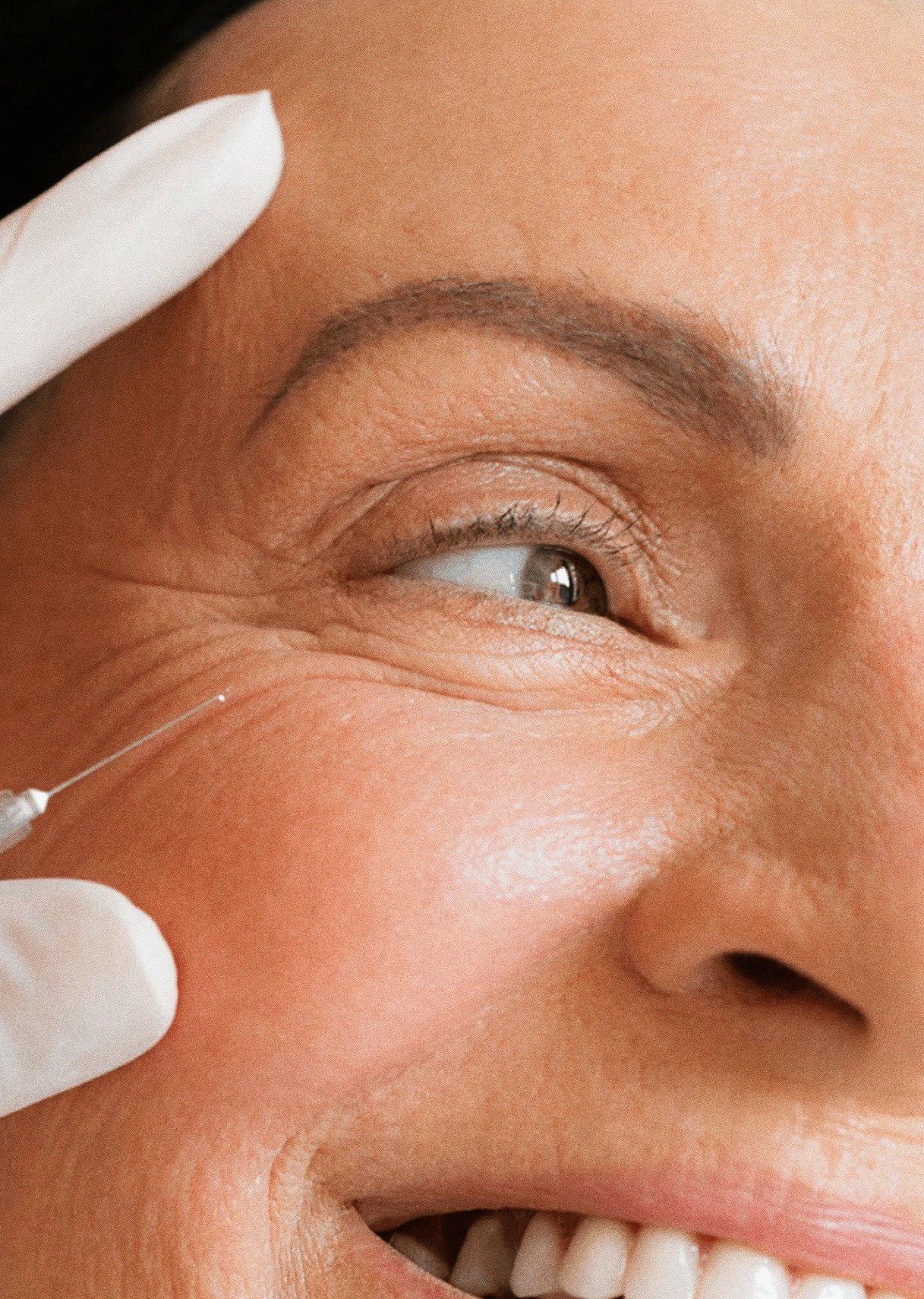 Henkilö saa silmänympäryksiin injektionin, lääkäri tai hoitaja pitää kiinni kasvoista.