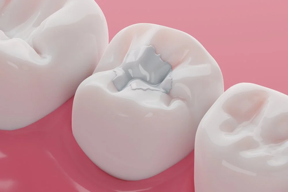 Close-up of three white dental crowns with a pink background, showing detailed porcelain surfaces and metal cores.