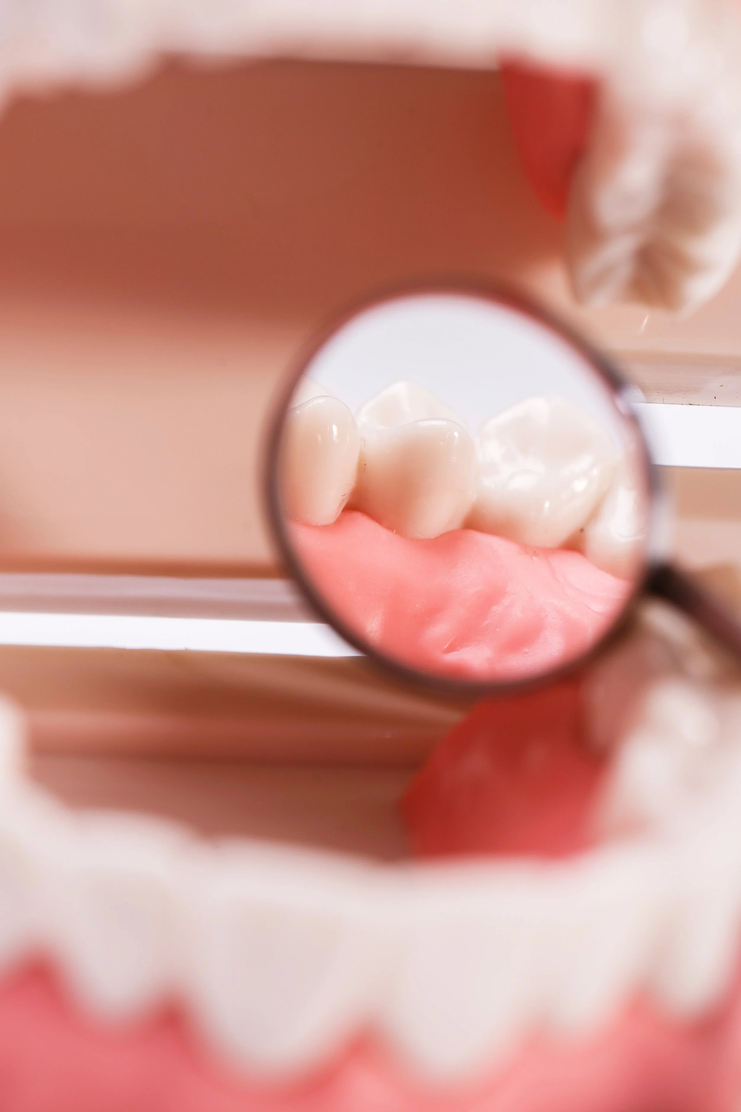 A close-up of artificial teeth and gums viewed through a magnifying glass, with a blurred background showing a dental model.