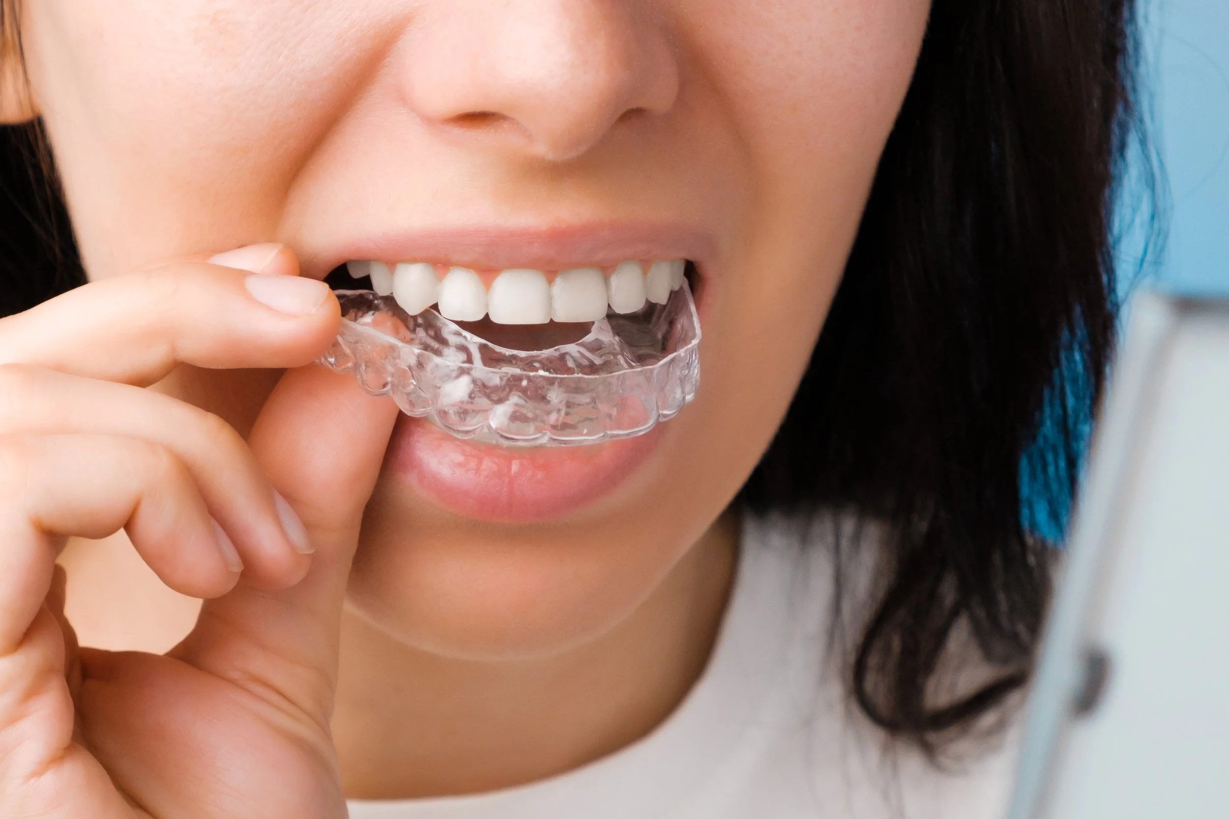 A woman is holding a clear dental retainer near her mouth, about to put it in.
