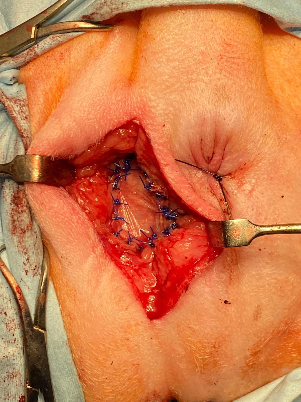 SIS+ multi laminate biologic graft used to augment the internal obturator muscle during perineal herniorrhaphy, shown in place
