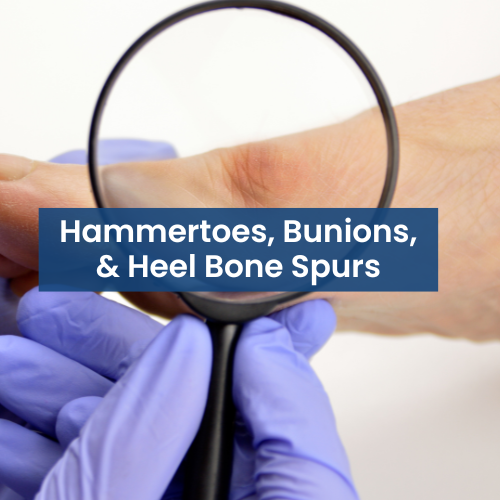 Close-up of a medical professional examining a patient's foot with a magnifying glass, with text overlay reading 'Hammertoes, Bunions, & Heel Bone Spurs'.
