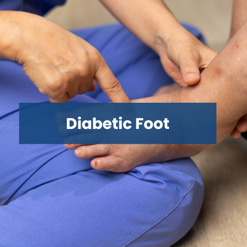 Close-up of a person pointing at a diabetic foot on a patient's foot, with the text 'Diabetic Foot' overlayed.