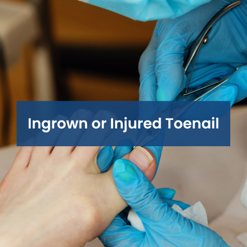 Medical professional examining a person's toe, indicating an ingrown or injured toenail.