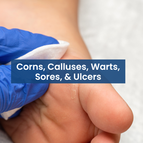 Close-up of a person's large toe with a gloved hand holding a cotton swab, with text overlay about corns, calluses, warts, sores, and ulcers.