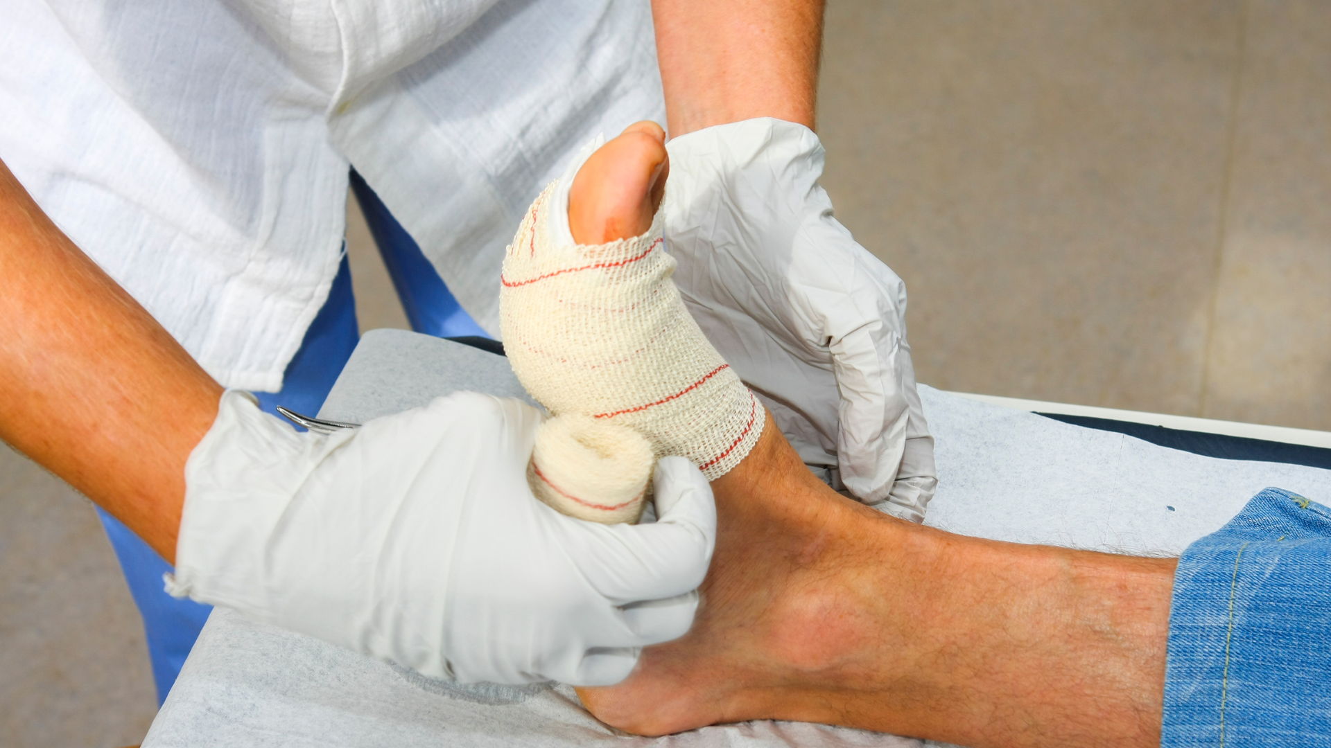 Why Foot Wounds Should Never Be Ignored
