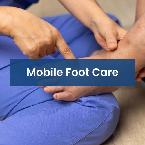 Close-up of a foot being examined or treated, with a healthcare professional pointing at the foot, labeled 'Mobile Foot Care'.