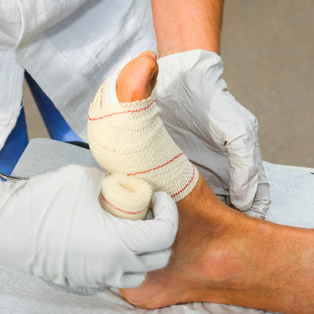 Medical professional applying a bandage to a person's ankle in a clinical setting.