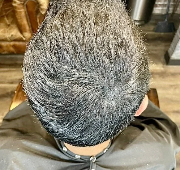 Bald spot after SOLUTION