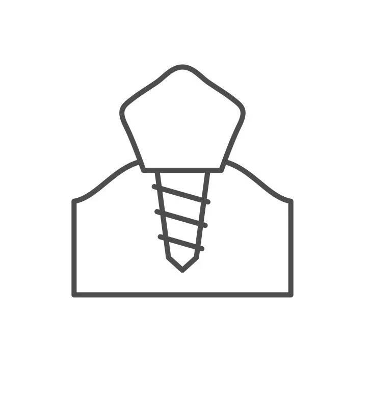 Outline illustration of a screw implant structure