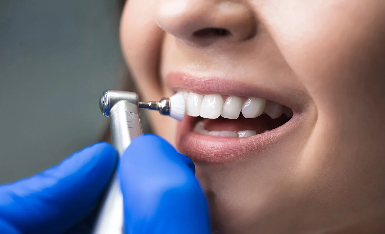 Dental cleaning near me