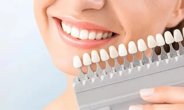 Close-up of a person smiling with a dental shade guide showing different tooth colors.
