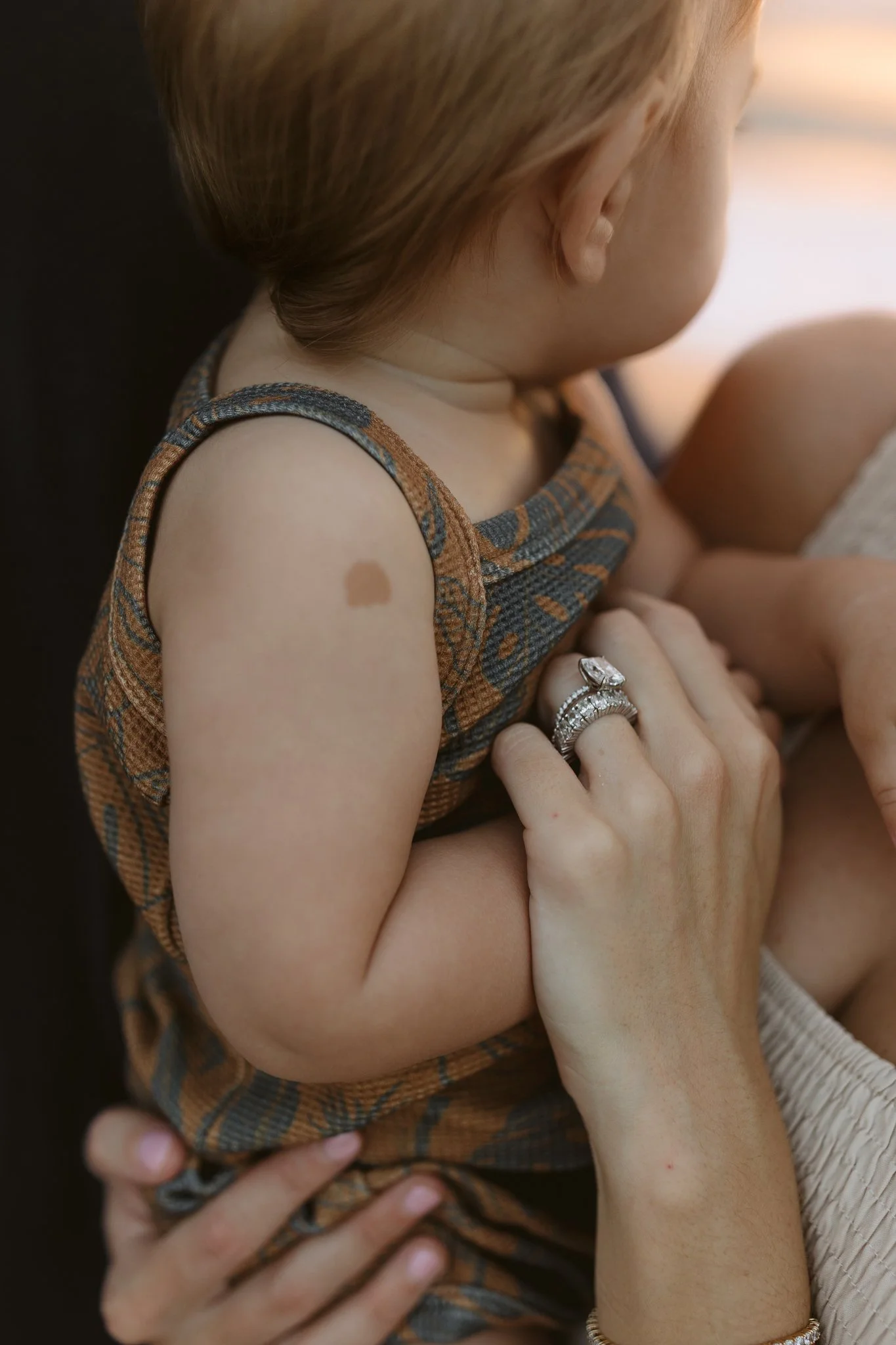 Close-up of a woman holding a young child with a birthmark on her arm. The woman wears multiple rings on her fingers.
