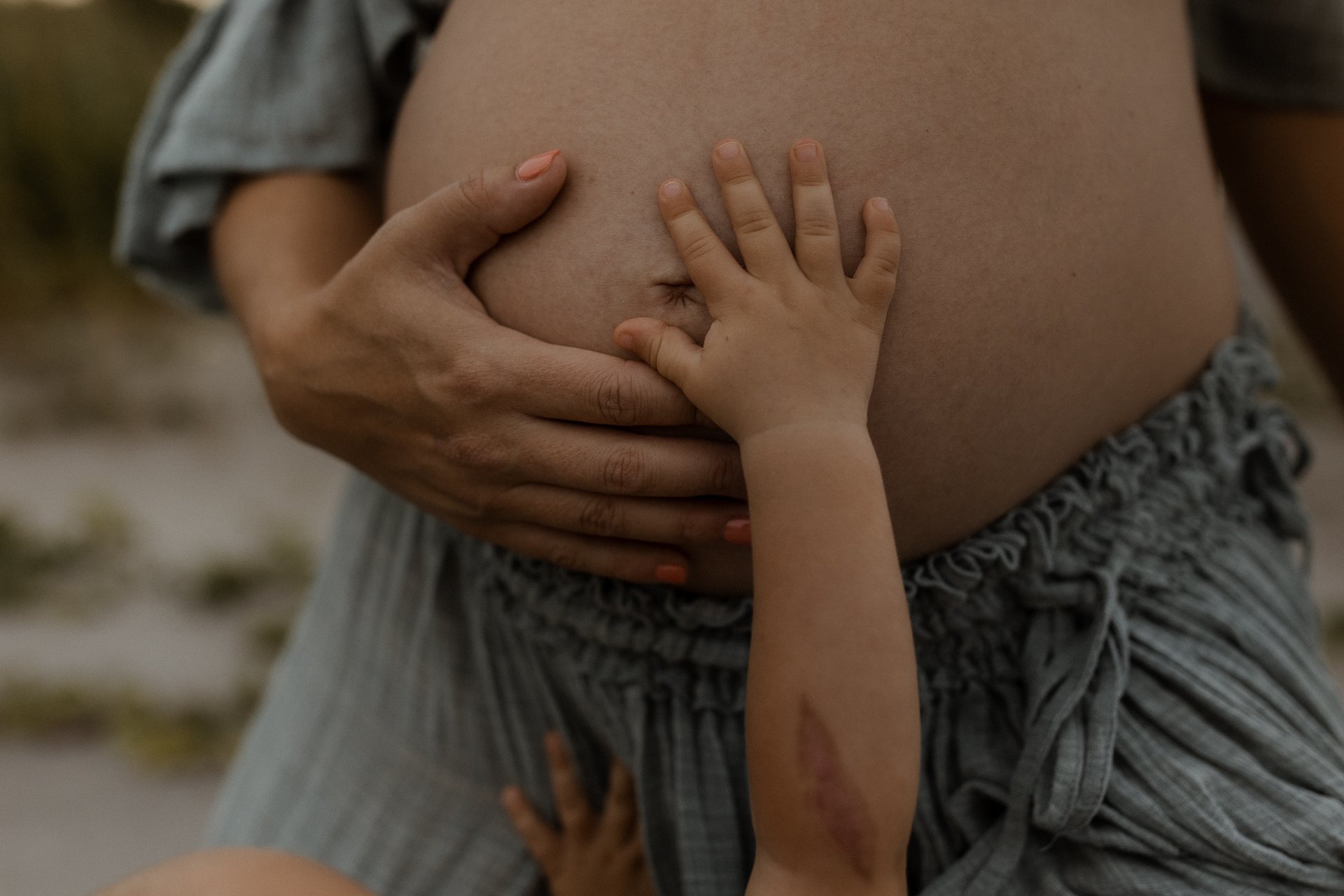 A small child's hand touching a pregnant woman's bare belly with a large scar on her arm.