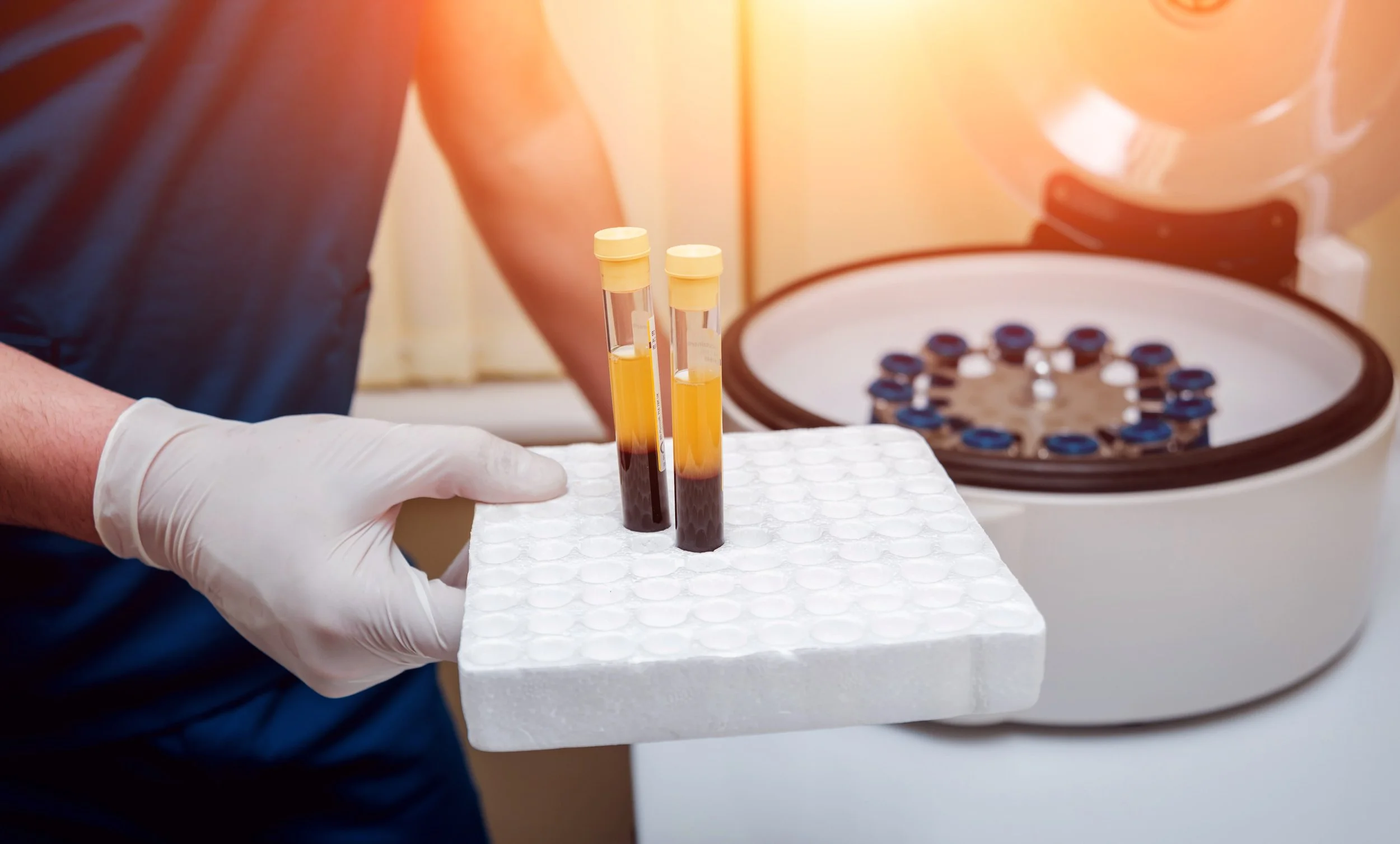 Person in gloves holding a tray with two blood sample tubes, in the background a centrifuge machine.