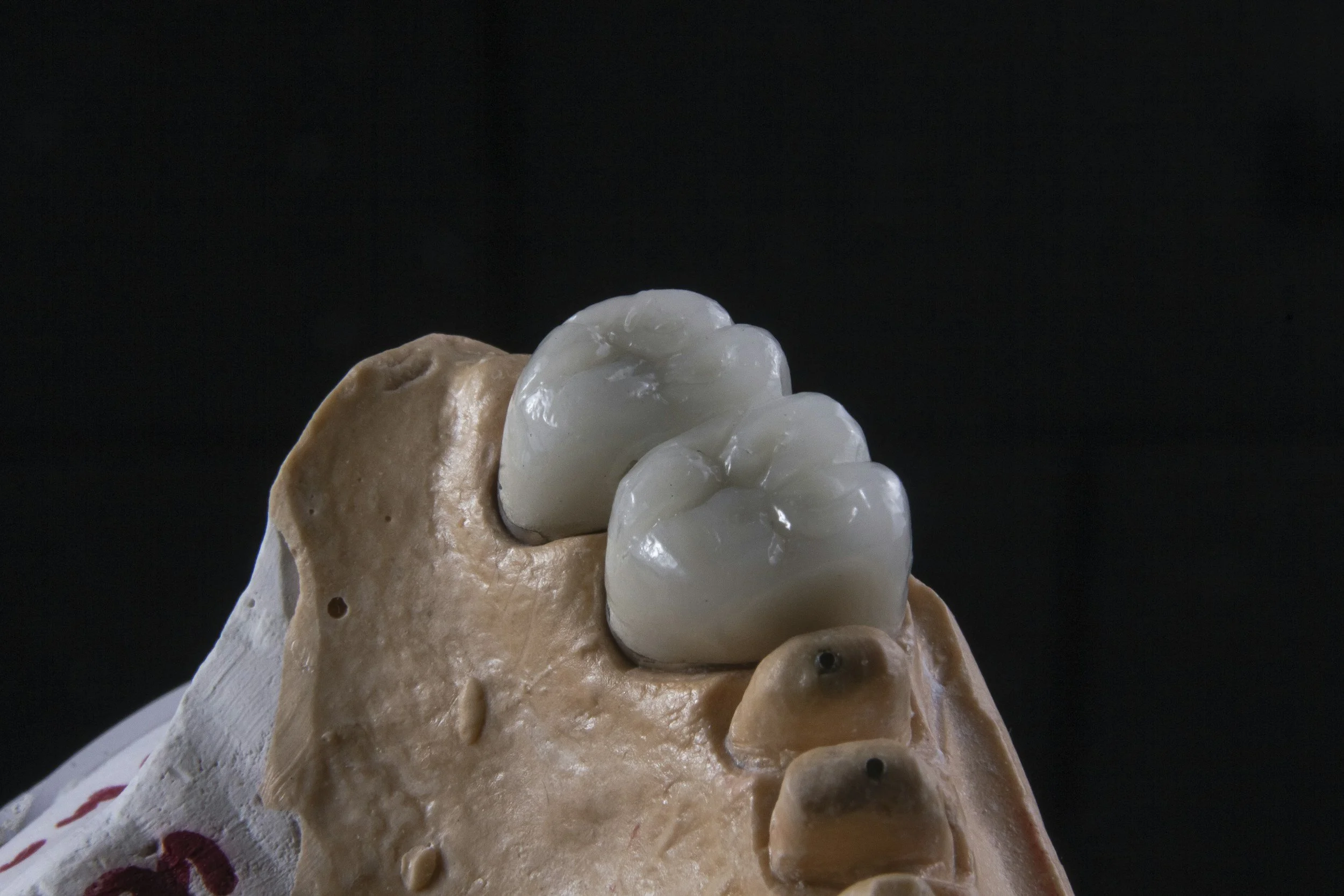 Close-up of a dental prosthetic or crown, made of ceramic or similar material, mounted on a beige-colored base, against a black background.