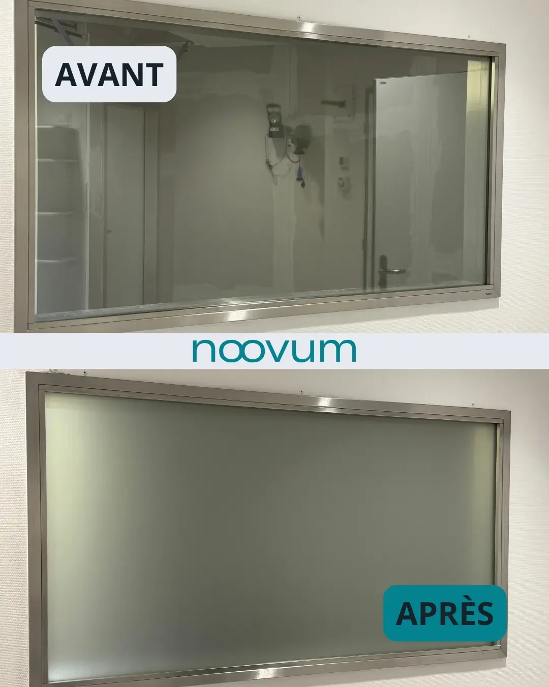 Comment améliorer l’intimité en hôpital sans travaux lourds